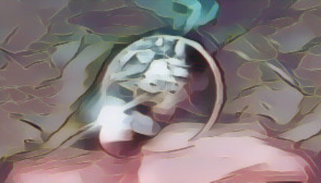 Death and Resurrection in Pluto